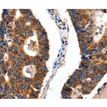 Immunohistochemistry - ITGB6 Antibody from Signalway Antibody (35783) - Antibodies.com