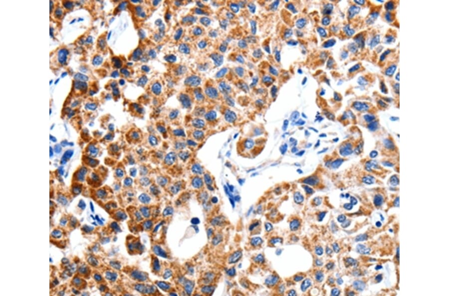 Immunohistochemistry - ITGB6 Antibody from Signalway Antibody (35783) - Antibodies.com