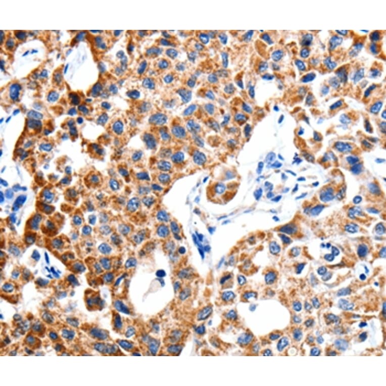Immunohistochemistry - ITGB6 Antibody from Signalway Antibody (35783) - Antibodies.com