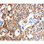Immunohistochemistry - ITGB6 Antibody from Signalway Antibody (35783) - Antibodies.com