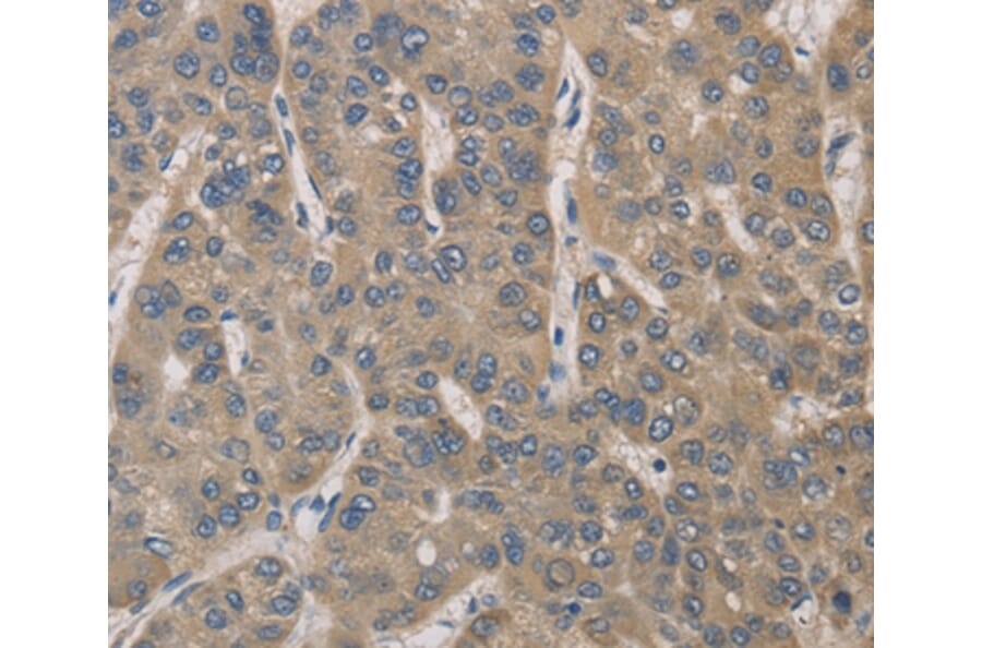 Immunohistochemistry - IRAK4 Antibody from Signalway Antibody (35788) - Antibodies.com