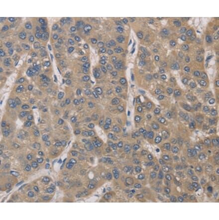 Immunohistochemistry - IRAK4 Antibody from Signalway Antibody (35788) - Antibodies.com