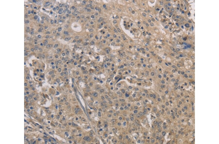 Immunohistochemistry - IRAK4 Antibody from Signalway Antibody (35788) - Antibodies.com
