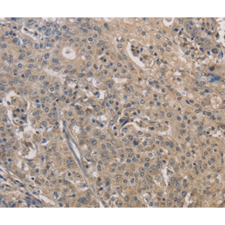 Immunohistochemistry - IRAK4 Antibody from Signalway Antibody (35788) - Antibodies.com