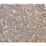 Immunohistochemistry - IRAK4 Antibody from Signalway Antibody (35788) - Antibodies.com