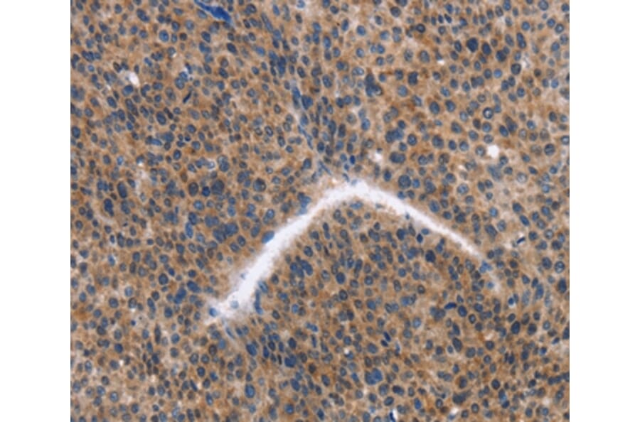 Immunohistochemistry - KLF15 Antibody from Signalway Antibody (35794) - Antibodies.com
