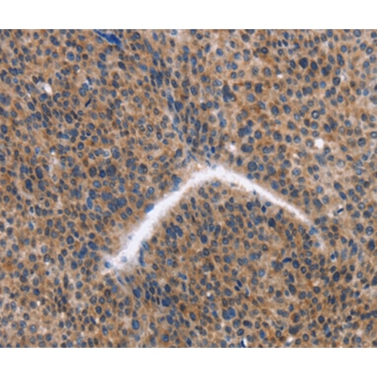 Immunohistochemistry - KLF15 Antibody from Signalway Antibody (35794) - Antibodies.com