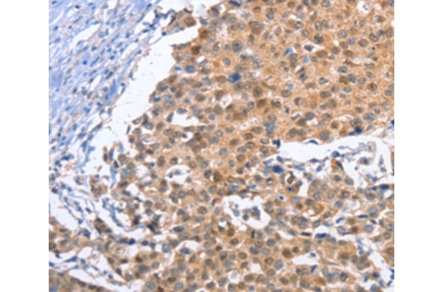 Immunohistochemistry - KLF15 Antibody from Signalway Antibody (35794) - Antibodies.com