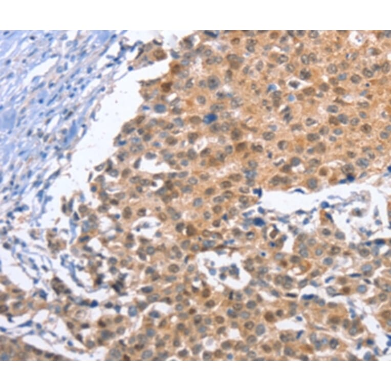 Immunohistochemistry - KLF15 Antibody from Signalway Antibody (35794) - Antibodies.com