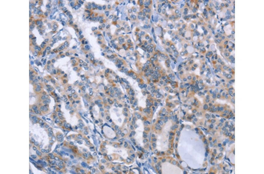 Immunohistochemistry - LRRK2 Antibody from Signalway Antibody (35803) - Antibodies.com