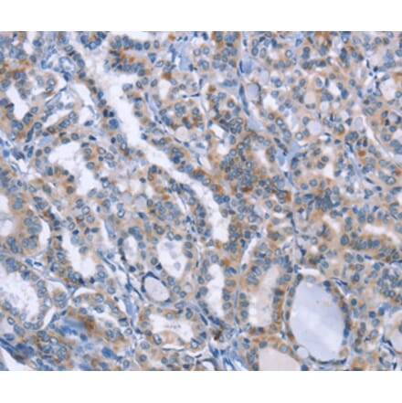 Immunohistochemistry - LRRK2 Antibody from Signalway Antibody (35803) - Antibodies.com