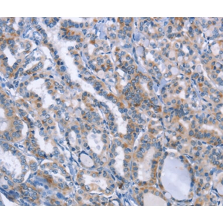 Immunohistochemistry - LRRK2 Antibody from Signalway Antibody (35803) - Antibodies.com