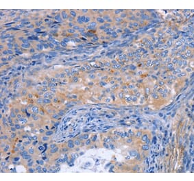 Immunohistochemistry - MATN3 Antibody from Signalway Antibody (35809) - Antibodies.com