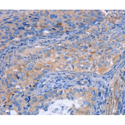 Immunohistochemistry - MATN3 Antibody from Signalway Antibody (35809) - Antibodies.com