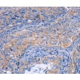 Immunohistochemistry - MATN3 Antibody from Signalway Antibody (35809) - Antibodies.com