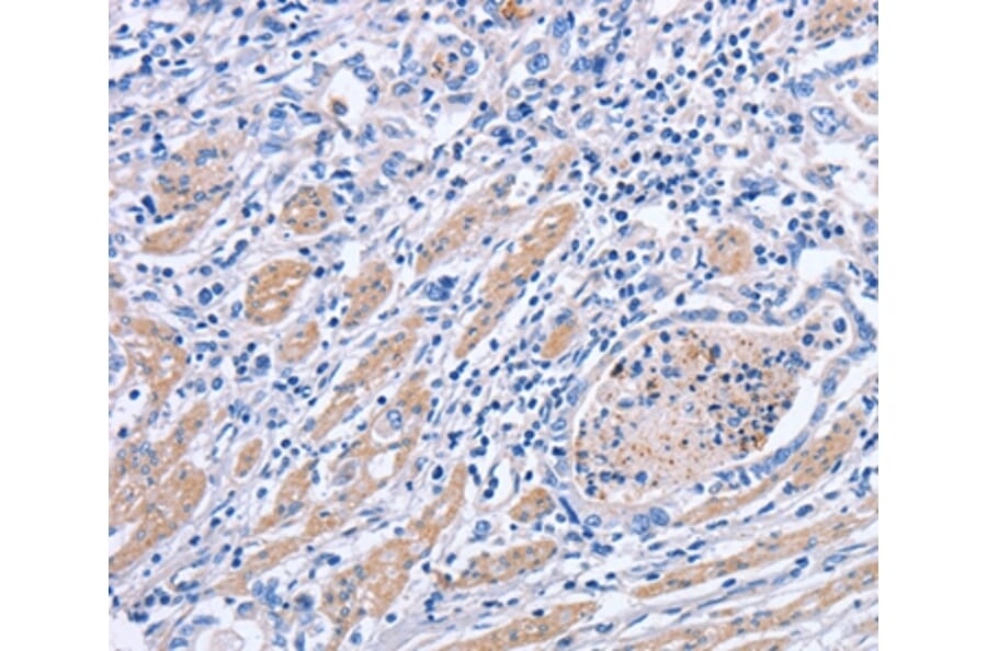Immunohistochemistry - MATN3 Antibody from Signalway Antibody (35809) - Antibodies.com