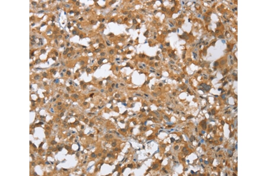 Immunohistochemistry - MMP12 Antibody from Signalway Antibody (35817) - Antibodies.com