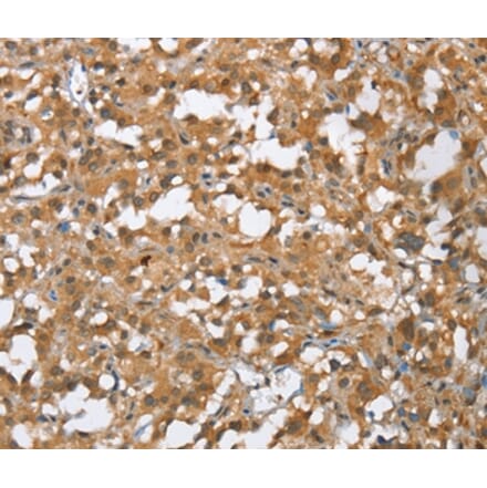 Immunohistochemistry - MMP12 Antibody from Signalway Antibody (35817) - Antibodies.com