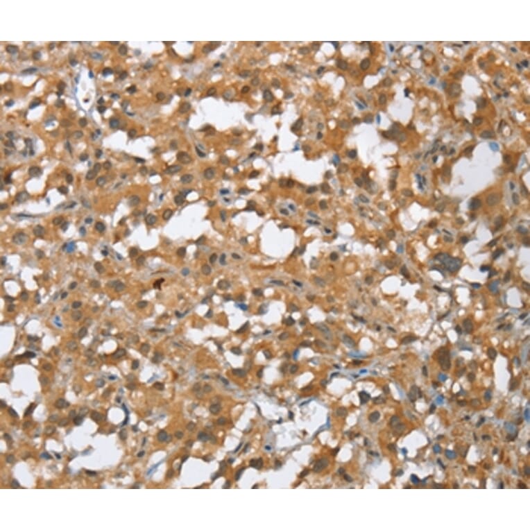 Immunohistochemistry - MMP12 Antibody from Signalway Antibody (35817) - Antibodies.com