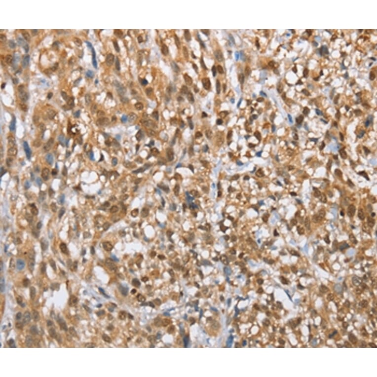 Immunohistochemistry - MMP12 Antibody from Signalway Antibody (35817) - Antibodies.com