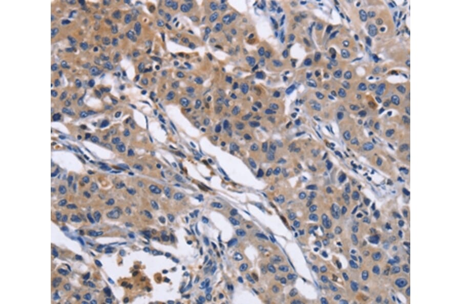Immunohistochemistry - MMP16 Antibody from Signalway Antibody (35818) - Antibodies.com
