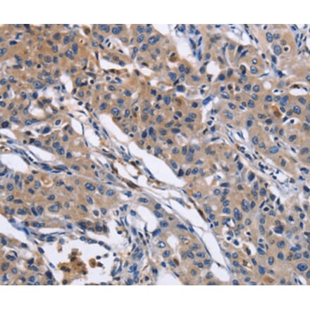 Immunohistochemistry - MMP16 Antibody from Signalway Antibody (35818) - Antibodies.com
