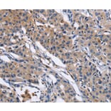 Immunohistochemistry - MMP16 Antibody from Signalway Antibody (35818) - Antibodies.com