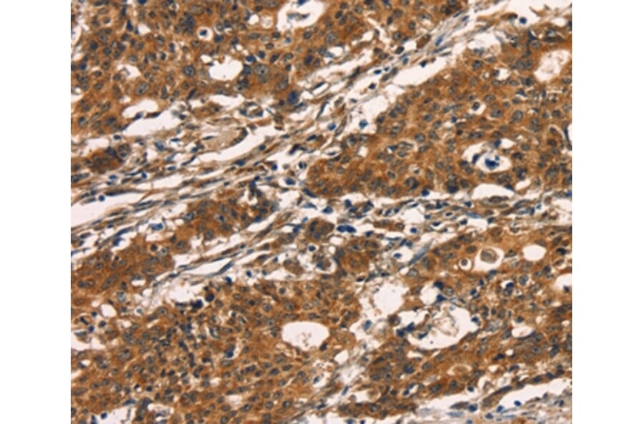 Immunohistochemistry - KLRC1 Antibody from Signalway Antibody (35839) - Antibodies.com
