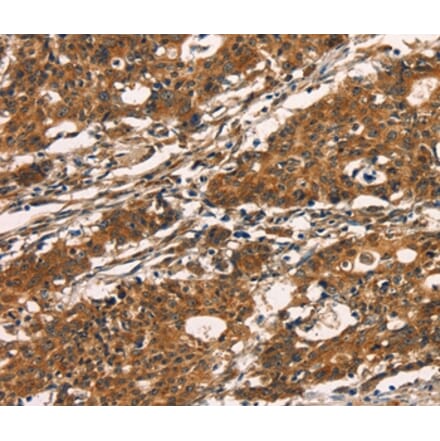 Immunohistochemistry - KLRC1 Antibody from Signalway Antibody (35839) - Antibodies.com