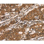 Immunohistochemistry - KLRC1 Antibody from Signalway Antibody (35839) - Antibodies.com