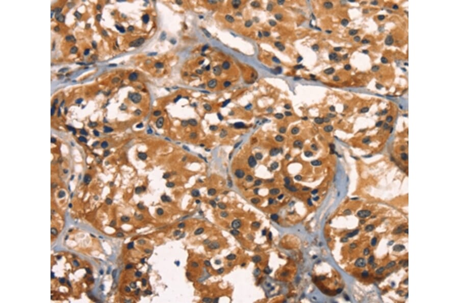 Immunohistochemistry - KLRC1 Antibody from Signalway Antibody (35839) - Antibodies.com