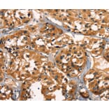 Immunohistochemistry - KLRC1 Antibody from Signalway Antibody (35839) - Antibodies.com