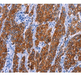 Immunohistochemistry - NR4A2 Antibody from Signalway Antibody (35847) - Antibodies.com