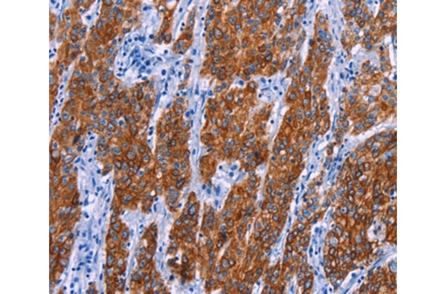 Immunohistochemistry - NR4A2 Antibody from Signalway Antibody (35847) - Antibodies.com