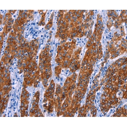 Immunohistochemistry - NR4A2 Antibody from Signalway Antibody (35847) - Antibodies.com