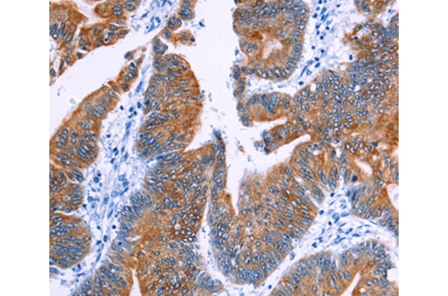 Immunohistochemistry - NR4A2 Antibody from Signalway Antibody (35847) - Antibodies.com