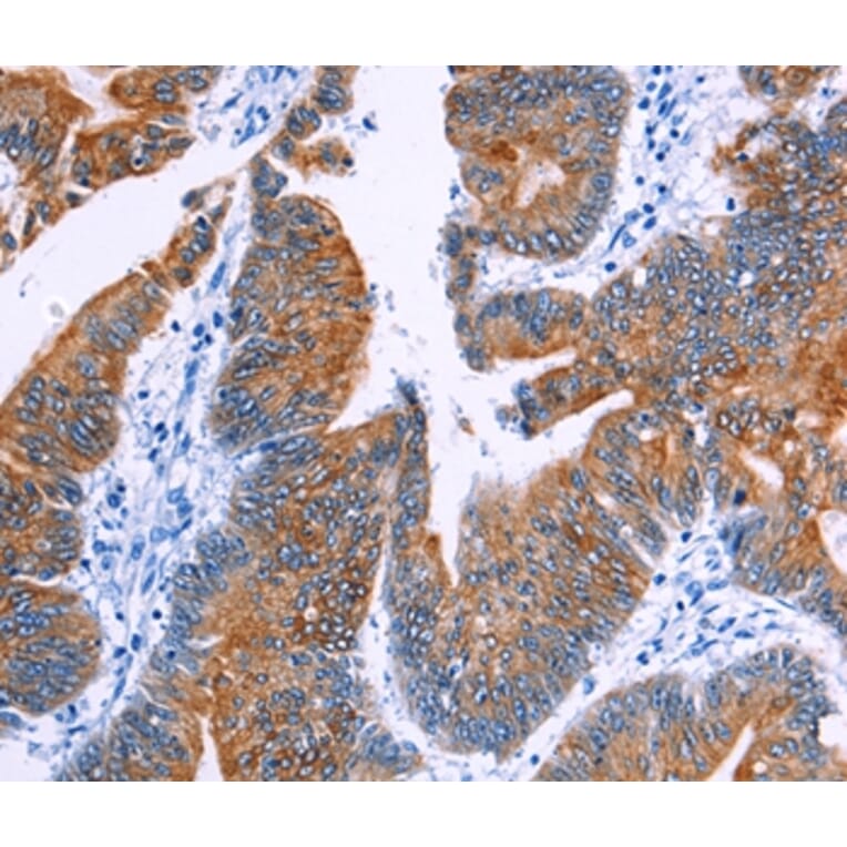 Immunohistochemistry - NR4A2 Antibody from Signalway Antibody (35847) - Antibodies.com
