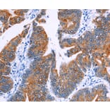 Immunohistochemistry - NR4A2 Antibody from Signalway Antibody (35847) - Antibodies.com