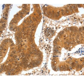 Immunohistochemistry - SPDEF Antibody from Signalway Antibody (35874) - Antibodies.com