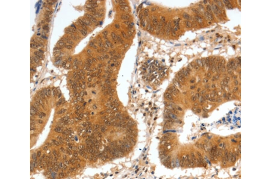 Immunohistochemistry - SPDEF Antibody from Signalway Antibody (35874) - Antibodies.com