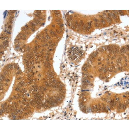 Immunohistochemistry - SPDEF Antibody from Signalway Antibody (35874) - Antibodies.com