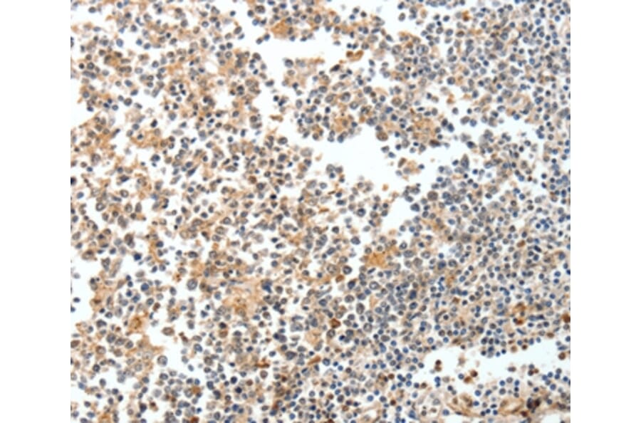 Immunohistochemistry - SPDEF Antibody from Signalway Antibody (35874) - Antibodies.com