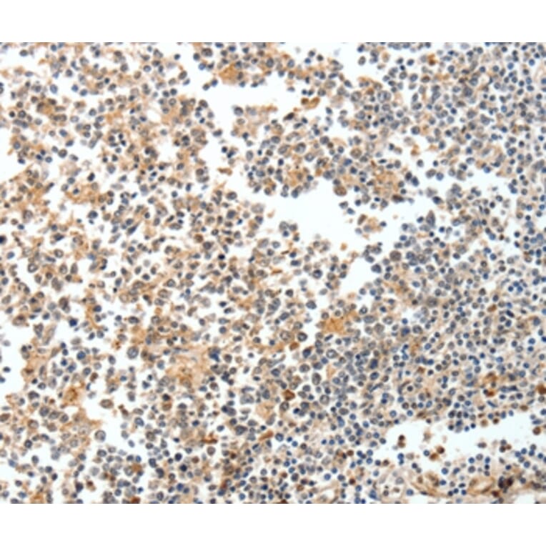 Immunohistochemistry - SPDEF Antibody from Signalway Antibody (35874) - Antibodies.com