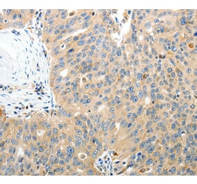 Immunohistochemistry - RAMP3 Antibody from Signalway Antibody (35886) - Antibodies.com