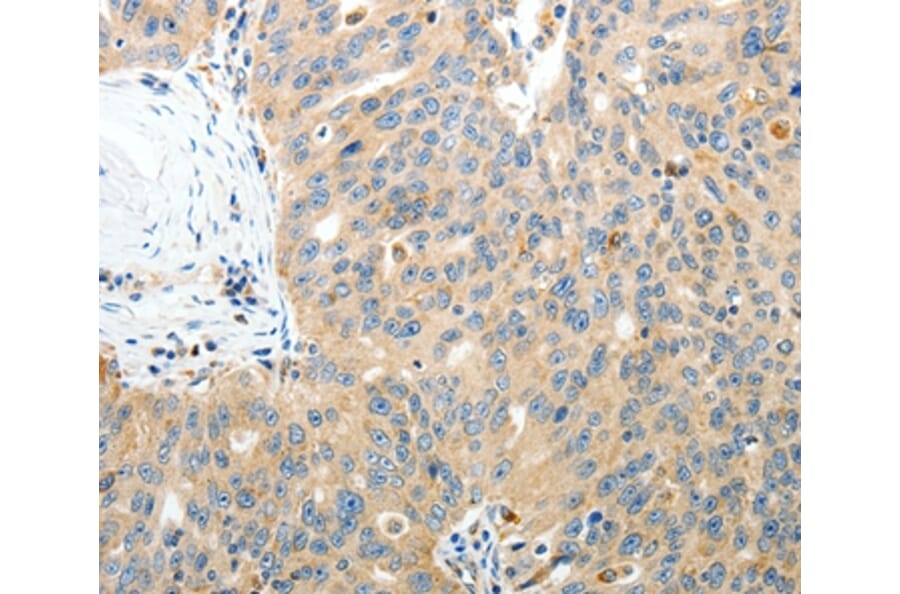 Immunohistochemistry - RAMP3 Antibody from Signalway Antibody (35886) - Antibodies.com