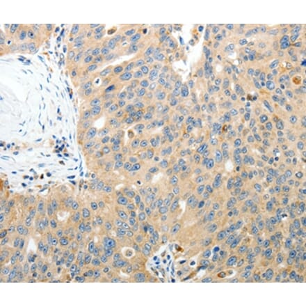 Immunohistochemistry - RAMP3 Antibody from Signalway Antibody (35886) - Antibodies.com