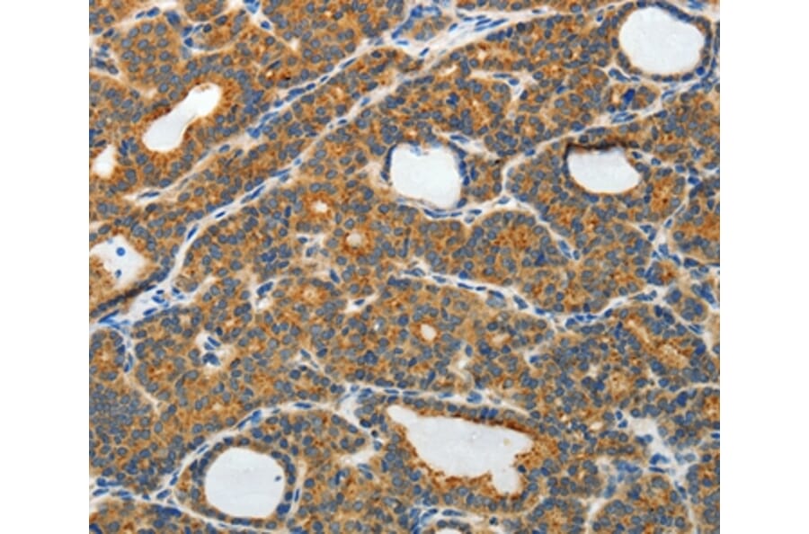 Immunohistochemistry - RAMP3 Antibody from Signalway Antibody (35886) - Antibodies.com