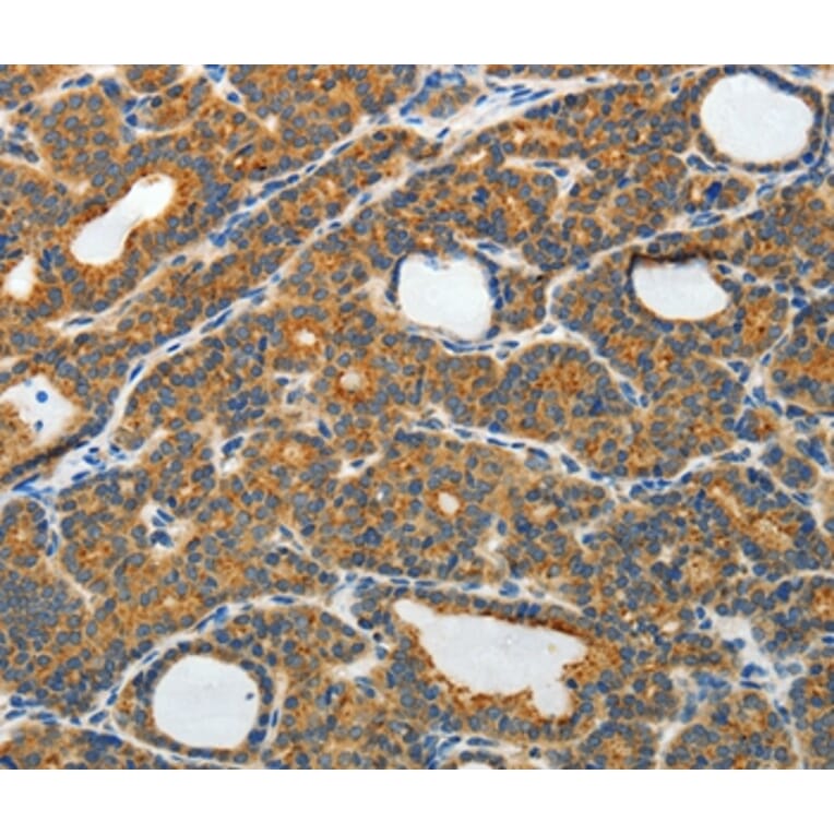 Immunohistochemistry - RAMP3 Antibody from Signalway Antibody (35886) - Antibodies.com