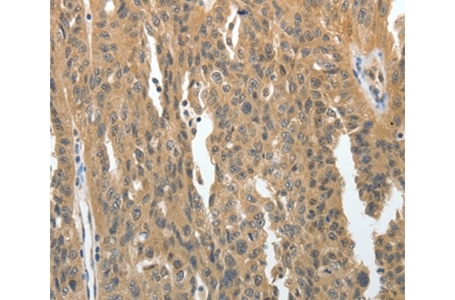 Immunohistochemistry - PRMT2 Antibody from Signalway Antibody (35888) - Antibodies.com