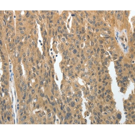 Immunohistochemistry - PRMT2 Antibody from Signalway Antibody (35888) - Antibodies.com